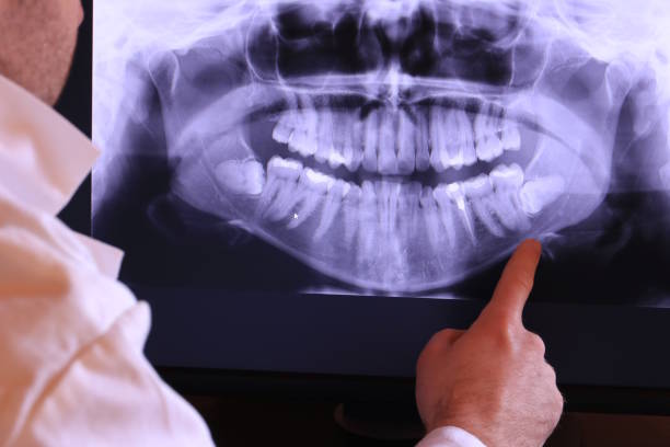 Best Dentist for Dental Trauma  in Shil, OH